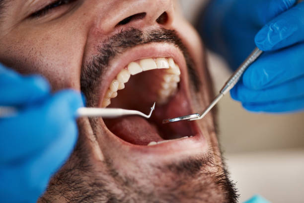 Best Sedation Dentistry  in Layhill, MD